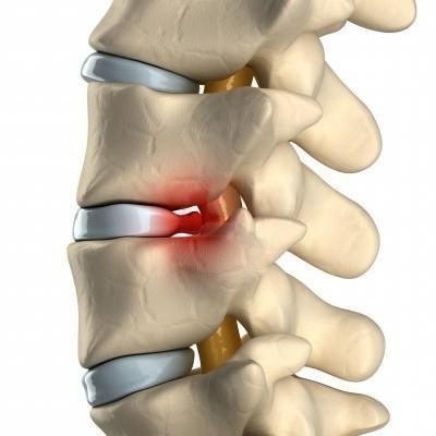 Болит спина и пах справа