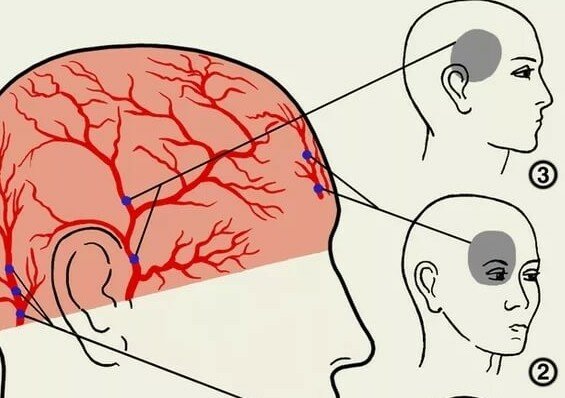 От чего может болеть глаза и голова