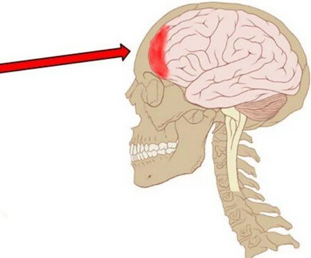 Болит лобная часть головы