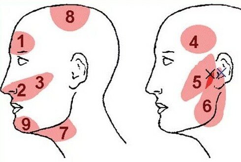 Сильно болит голова ломит виски