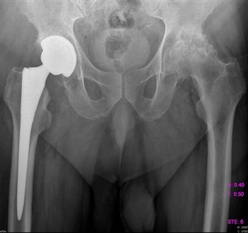 Болит спина и пах справа