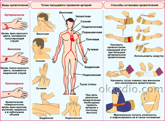 способы остановки кровотечений