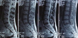 Если крутит ноги и болит спина
