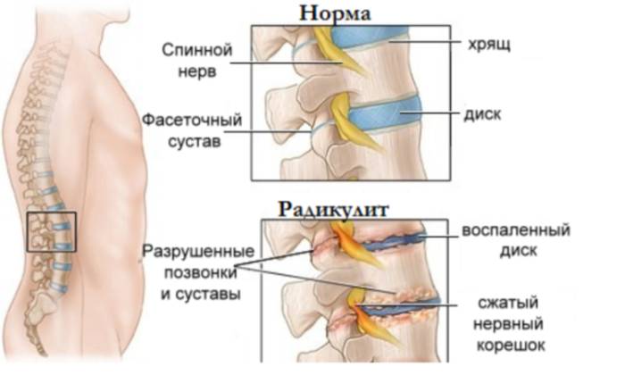 От велотренажера может болеть спина
