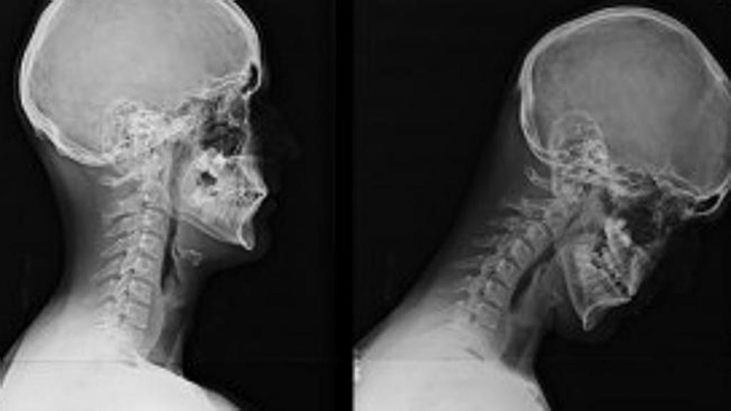 диагностики причин боли в шее