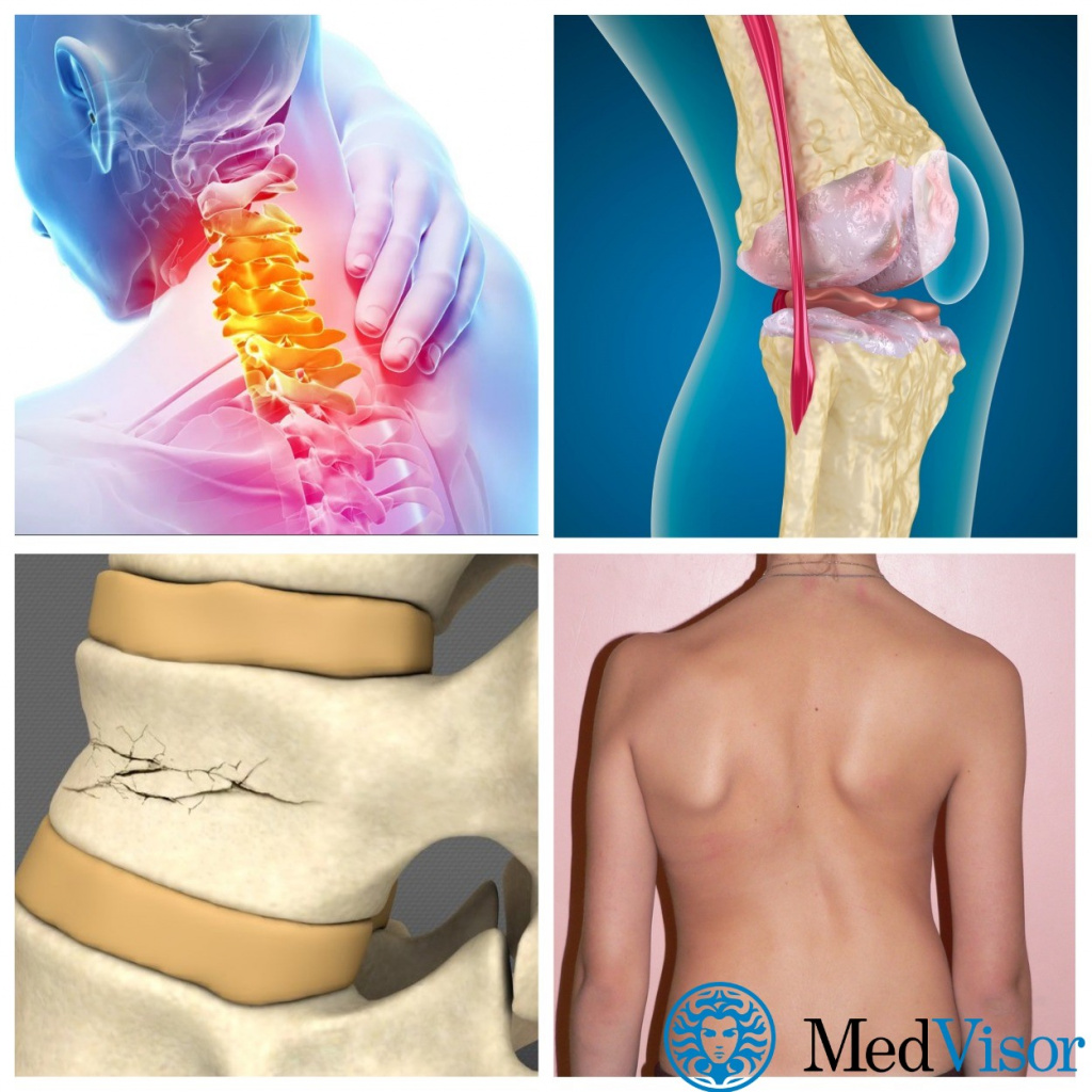 Другие проблемы со спиной Осеннее обострение болей в спине