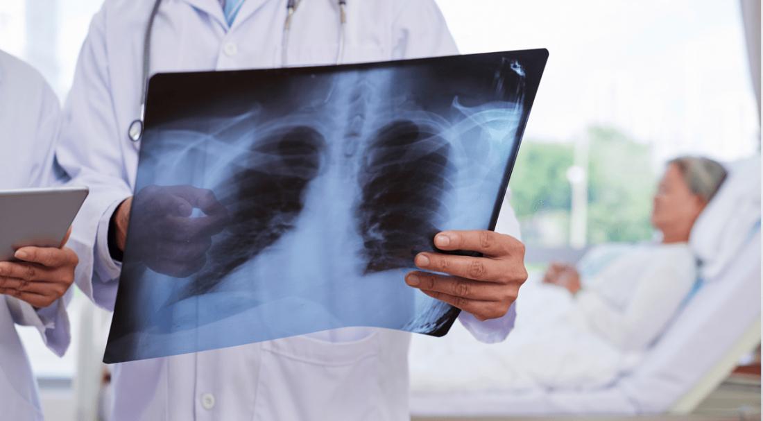 Почему после сдачи крови из вены болит голова