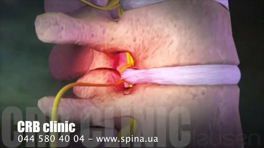 Очень болит спина в нижней части