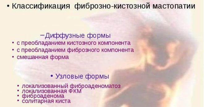Классификация мастопатии