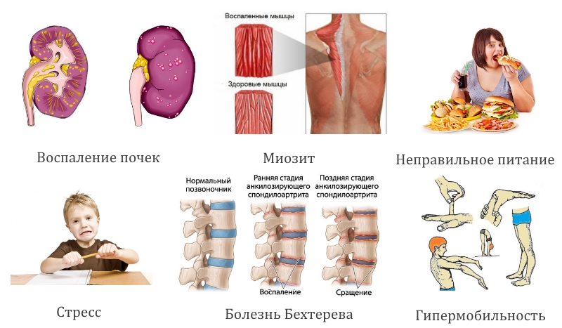 Частые причины боли в спине у детей Частые причины боли в спине у детей