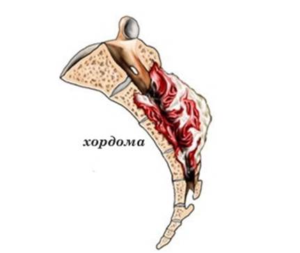 Если крутит ноги и болит спина