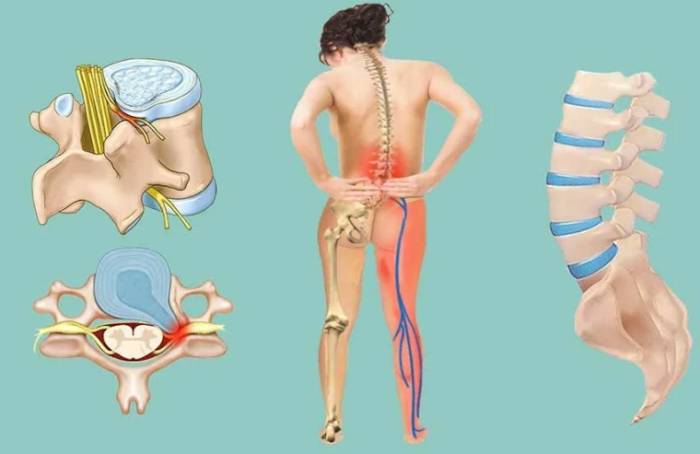 Если крутит ноги и болит спина