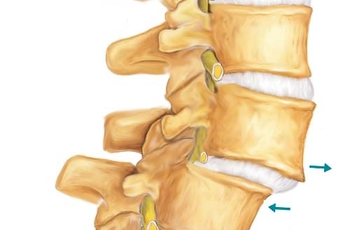 Хрустнул спиной теперь болит