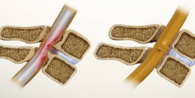 болит спина шея за ушами