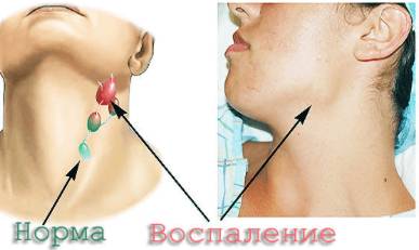 болит спина шея за ушами