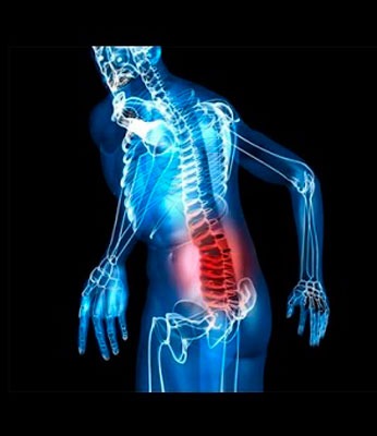 Сорвал спину