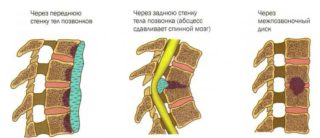 Если крутит ноги и болит спина