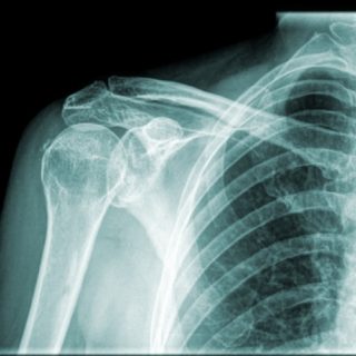 Болит спина справа у ключицы