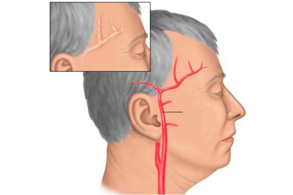 Постоянно болит голова обезболивающие не помогает