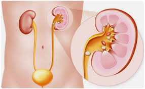 боль в почках у детей боль в почках у детей