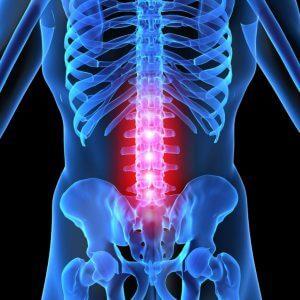 Что делать, болит спина в положении лежа