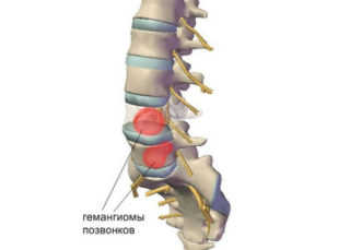 Болит спина при стоянии причины