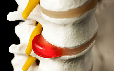 Болит спина и пах справа