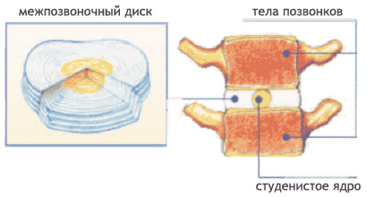 Для лечения и профилактики остеохондроза и болей в спине