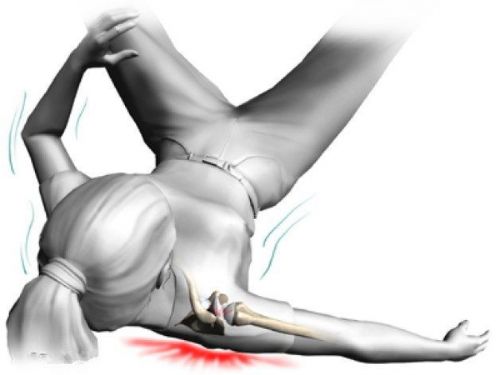 Падение на плечо