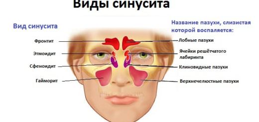 болит спина шея за ушами