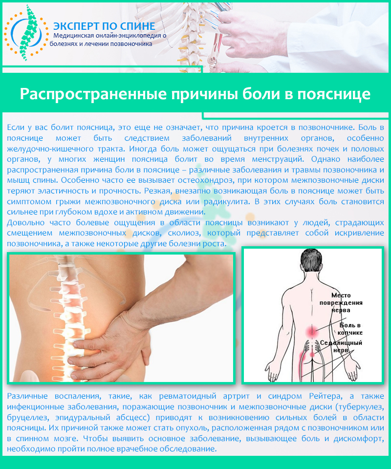 Распространенные причины боли в пояснице
