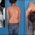 Болит спина отдает в грудь дышать