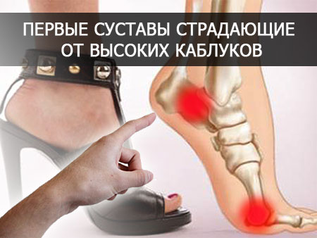 Как каблук влияет на суставы Высокий каблук и суставы