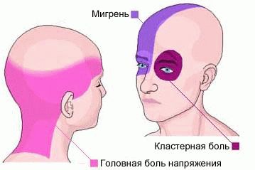 Постоянно болит голова обезболивающие не помогает